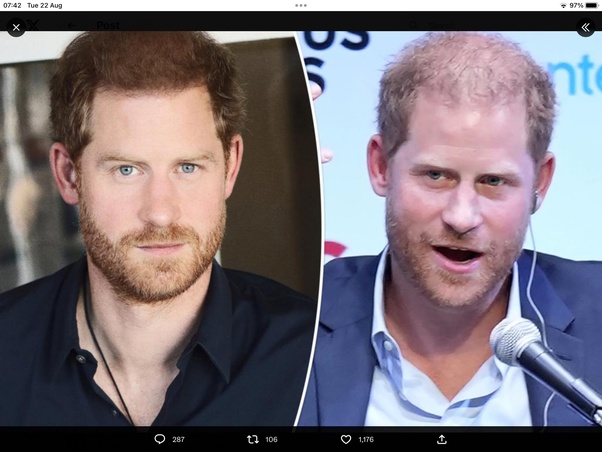 OMG You complete Fraud Hasno- yet again!👨🏼‍🦲
Here is the recent photo of #PrinceHarry which is circulating.
So is this laughable & pathetic transformation due to  upcoming Invictus!

Too late Hasno we already know!😂
#HarryandMeghanAreAJoke 
#PrinceHarryAndHisStupidWife