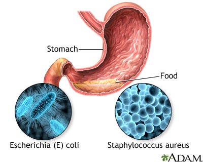 FoodMicrobiolo6's tweet photo. #Bacterialfoodborne infections occur when food, that is contaminated with bacteria, is eaten and the bacteria continues to grow in the intestines, setting up an infection which causes illness. Salmonella, #Campylobacter, hemorrhagic #E.coli and #Listeria all cause infections. https://t.co/NYstJE0hq3