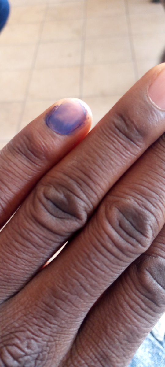 Voted successfully 🔥