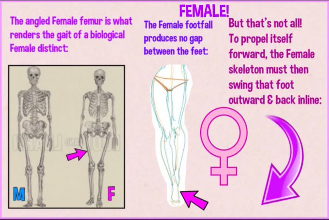 saltplasma's tweet photo. @SolBrah It says: "The holder of this sign is a biological female." You say supplements are necessary &amp; you sell them too. Yes, supplementing male hormones is necessary for a female to look like you🤡😂. Nice wide childbearing hips, curvy spine, long legs &amp; small torso. #EGI #raypeat https://t.co/pQecCQ4260
