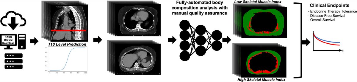 👍 🩻 radiology-☢️radiation oncology @ASarafMD2 collaboration leveraging radiation planning CT for muscle analysis in women with early-stage breast cancer to understand the link with toxicity-related discontinuation of adjuvant endocrine therapy 👉 tinyurl.com/2b6fyzz5 @IJROBP