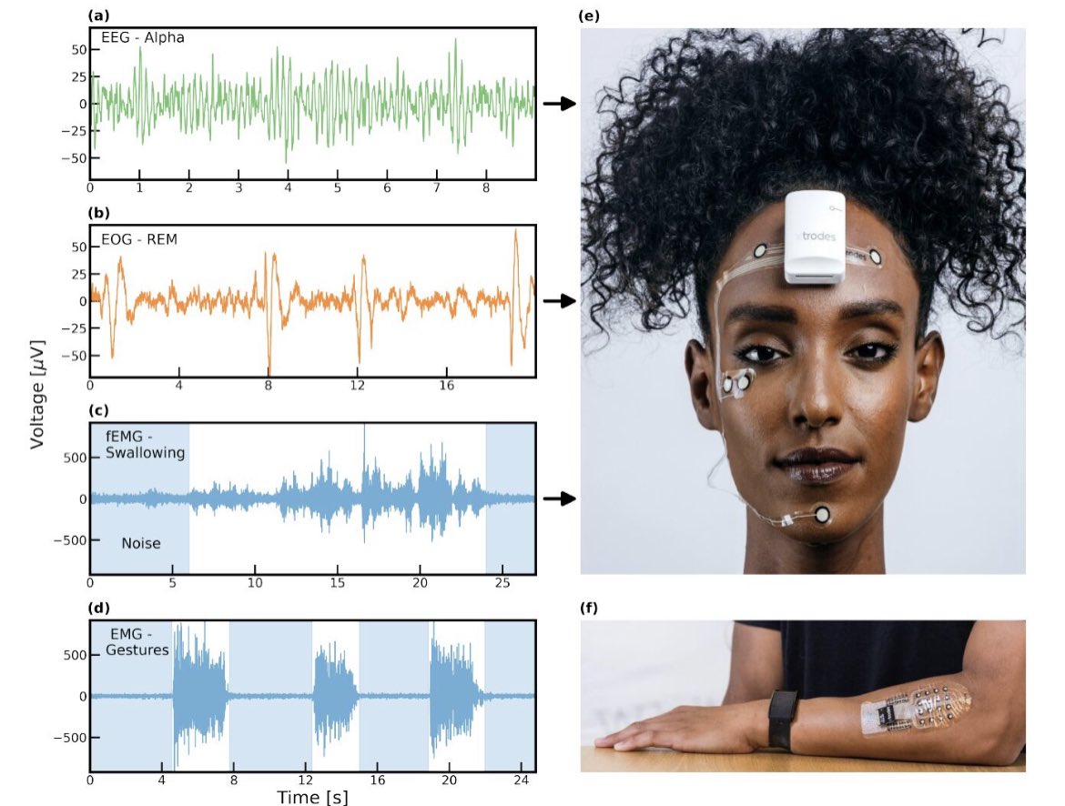 Yael Hanein tweet media