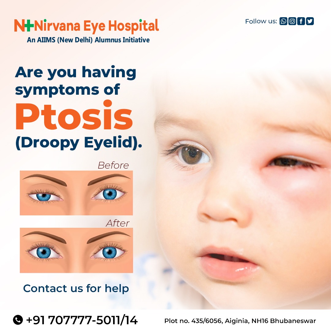 HospitalNirvana's tweet photo. 📞Contact us now to learn more about ptosis

#EyeHealth #OpticalCare #EyeClinic #VisionWellness #EyesightMatters #OptometryExpertise https://t.co/9TkEPQSHwo