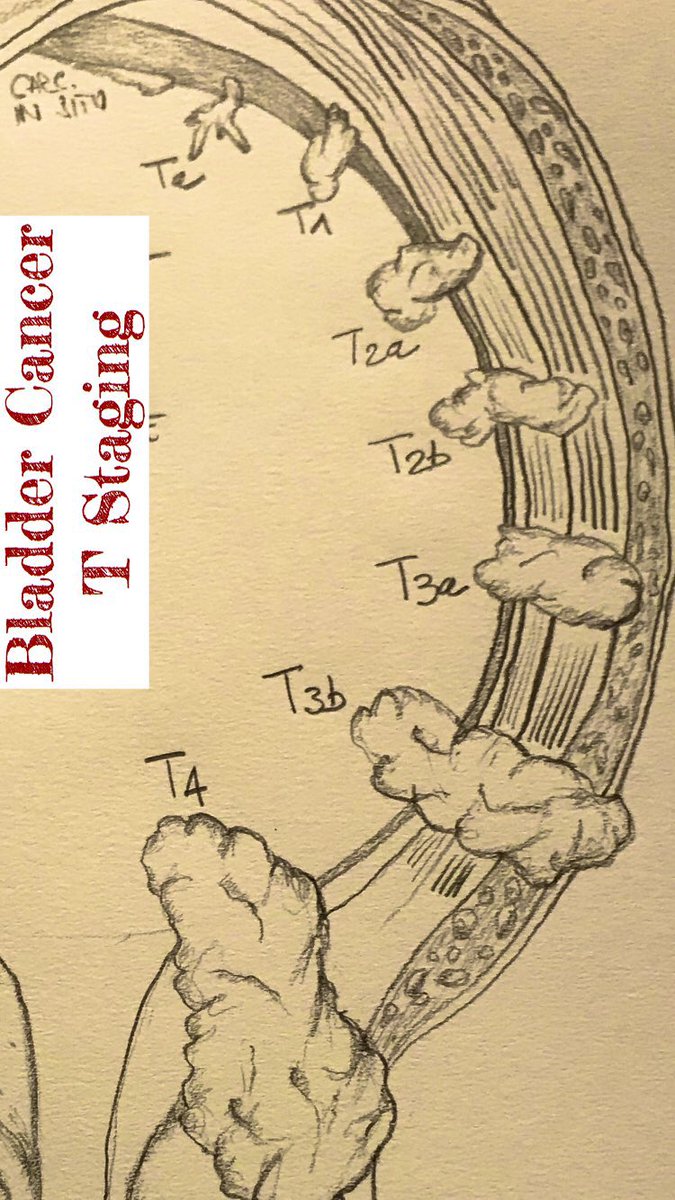 Bladder Cancer. @Uroweb