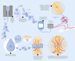 Omid_HopeUni's tweet photo. Bone fracture healing process👇🏼

> Fracture
> Haematoma (0-2 weeks)
> Callus formation (2-6 weeks)
> Hard callus formation (6-12 weeks) 
> Continued remodeling (months/years)

#bone #fracture #healing 
Credit: Lucy Reading-Ikkanda 
https://t.co/lj3xoHMaCs https://t.co/HzCbMJTo6I
