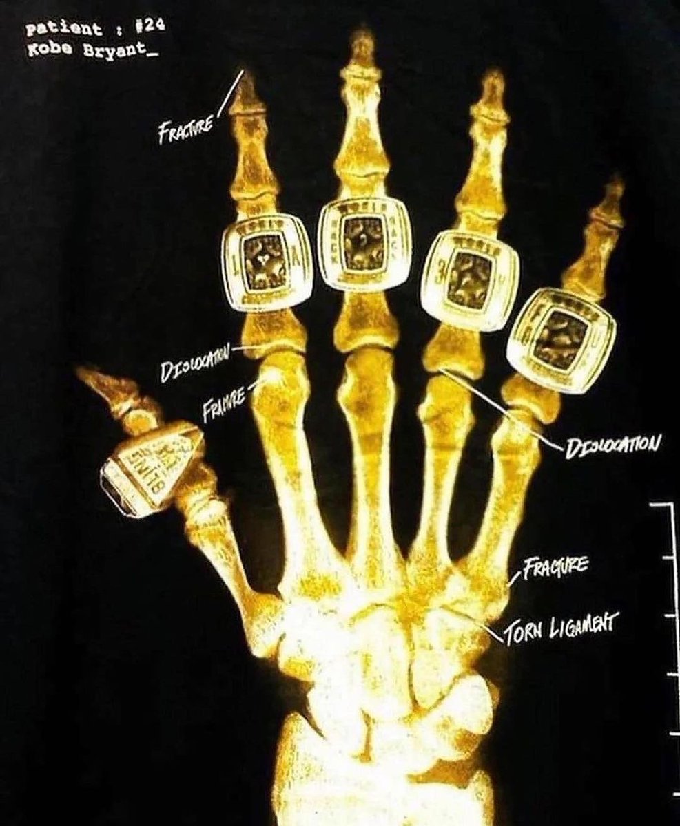 Kobe Bryant "Broken Not Beaten" Nike Campaign