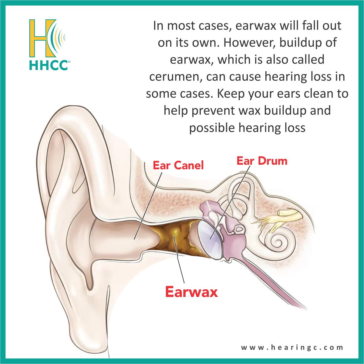 Caring for your ears is vital! Excessive earwax buildup can lead to hearing loss. Learn how to maintain healthy hearing. #EarHealth #HearingLossPrevention #EarCareTips #HHCCAS #ORS #hearingc #orevarehab