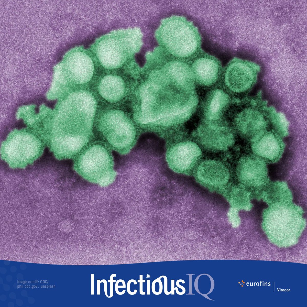 eurofinsviracor's tweet photo. Test your #InfectiousIQ! 🧫

Identify the virus in this digitally colorized negative stained TEM image. 🦠

Don’t hog all the character space in the comment section. 😉

#IDTwitter #WeAreID #highlymutated #IDweek2023 https://t.co/1O2HAA0NZl
