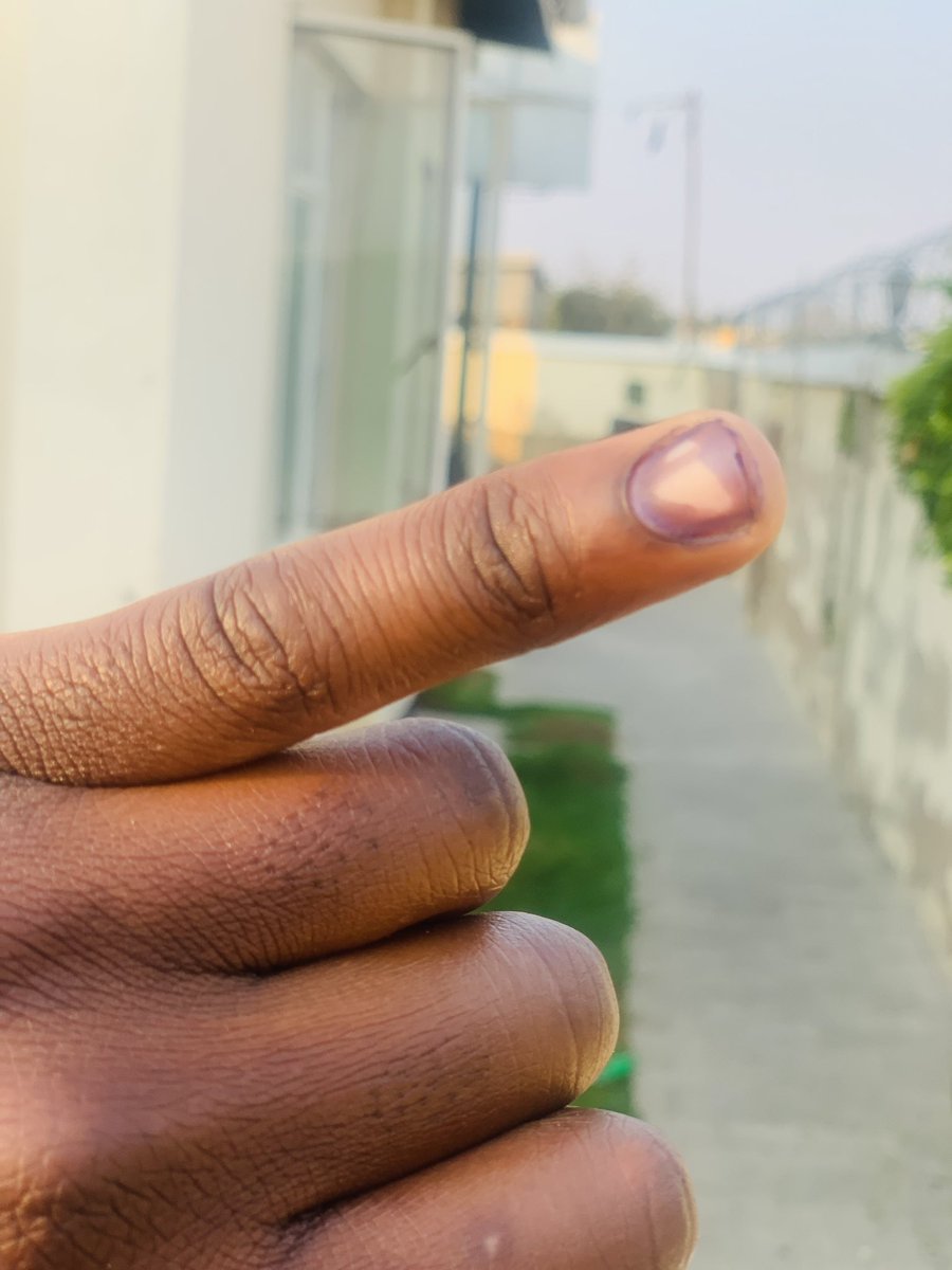 donhizworldwide's tweet photo. #ZimbabweDecides2023 
#ZimElections2023 

After a long day of frustration, I’ve decided my future. 🗳️ 

Have you? https://t.co/go7WgxoOSi