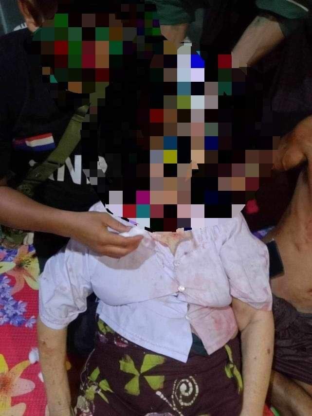 YeSoe91920267's tweet image. On Aug 19 afternoon, Terrorist military fired 2 heavy shells into Lakkoo village in #Palaw Tsp, an old woman aged 72 was killed for the shell hit beside her home.
#DoMoreSingapore
#NoMoreDirtyDeals
#2023Aug23Coup
#WhatsHappeningInMyanmar
@our_sg
@PAPSingapore
@wpsg
@SingaporeUN