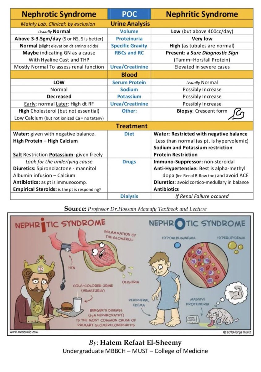 Medical_MD1's tweet photo. Nephritic vs Nephrotic syndrome🧐

Nephr”i”tic
 
👉🏼‘I’nflamation of the glomerular basement membrane 

HEMATURIA(Cola-Coloured urine)

-

Nephr”o”tic

👉🏼Podocyte’s damaged👉🏼Disrupts the glomular charge barrier(Loss of negative charge of GBM)

Massive PROTEINURIA✨

. https://t.co/RMkNUHwM6t