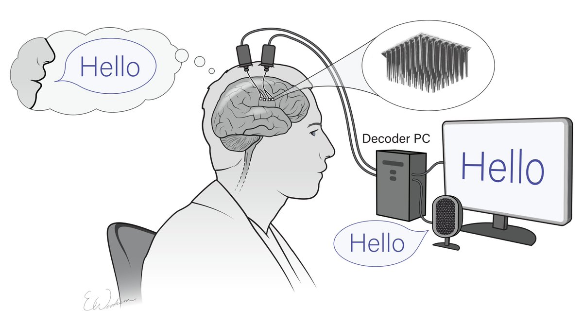 Our new study is out today in Nature! We demonstrate a brain-computer interface that turns speech-related neural activity into text, enabling a person with paralysis to communicate at 62 words per minute - 3.4 times faster than prior work. 1/3 nature.com/articles/s4158…