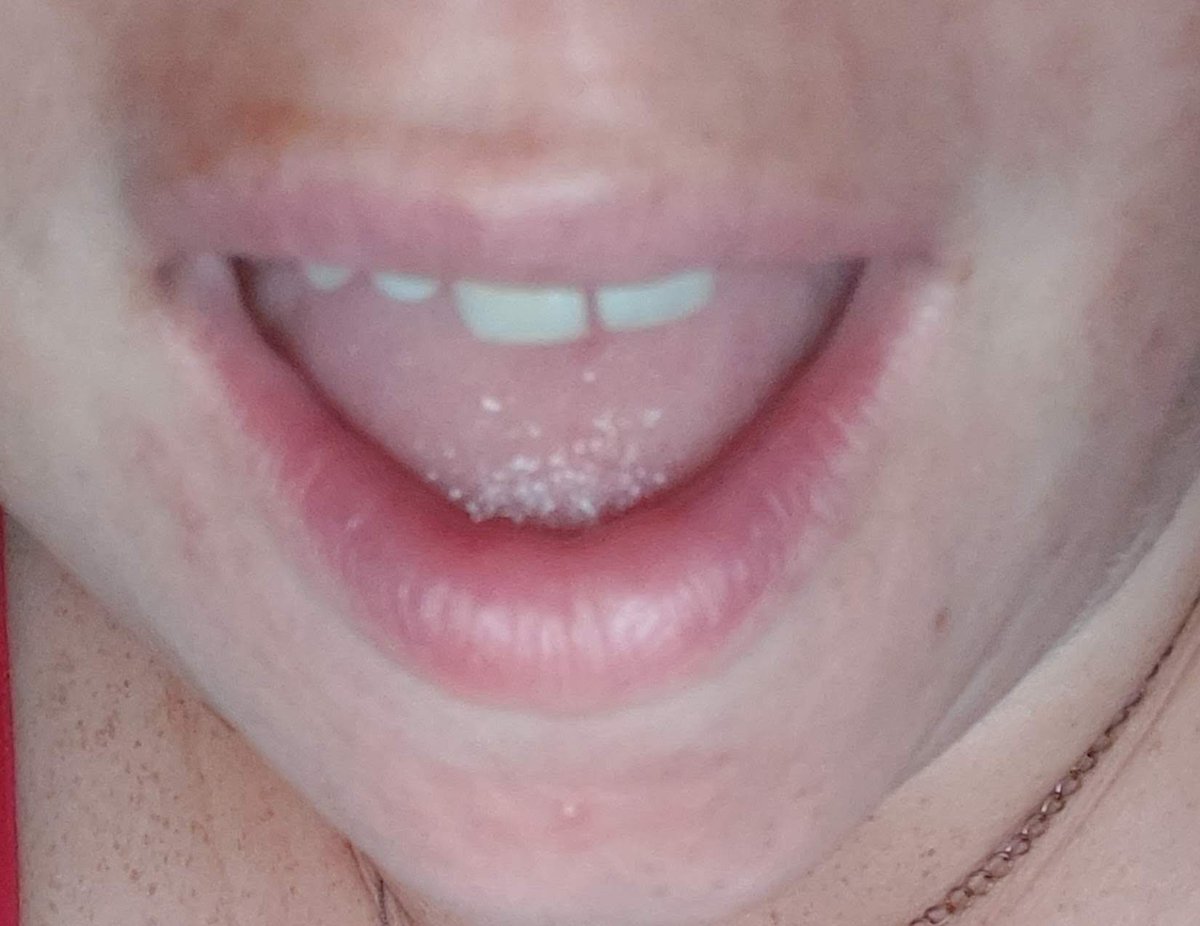 sparklygal85's tweet photo. This mouth has just tasted Amber Nectar....come over to my page to see the video 😍🔥😈 xx

https://t.co/CmrSGT1xaN https://t.co/5Spa2twkBk