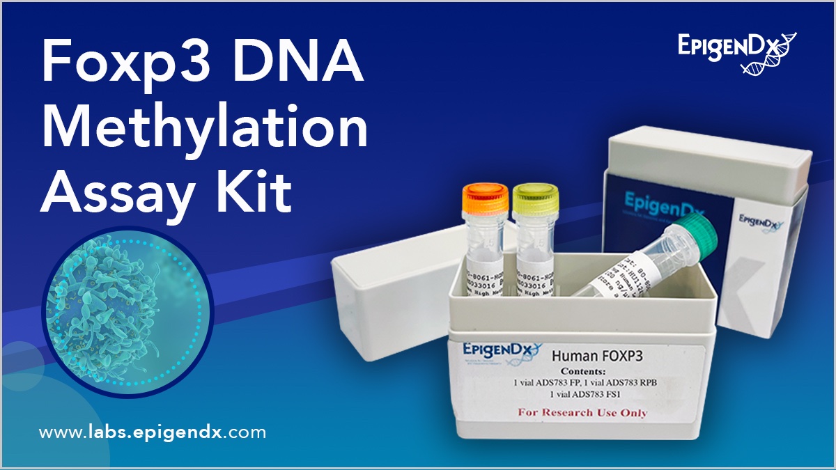 EpigenDx's tweet photo. Foxp3 DNA Methylation Assay Kit -  designed to provide quantification of CpG dinucleotide methylation in critical genes like FOXP3, PD-1, CTLA-4, &amp; more

Utilize:
• Pyrosequencing
• Bisulfite sequencing
• Targeted bisulfite NGS
• MS-HRM
 
🚀 #EpigenDx: https://t.co/HZCNdsHH6Z https://t.co/QayCAAkxsr