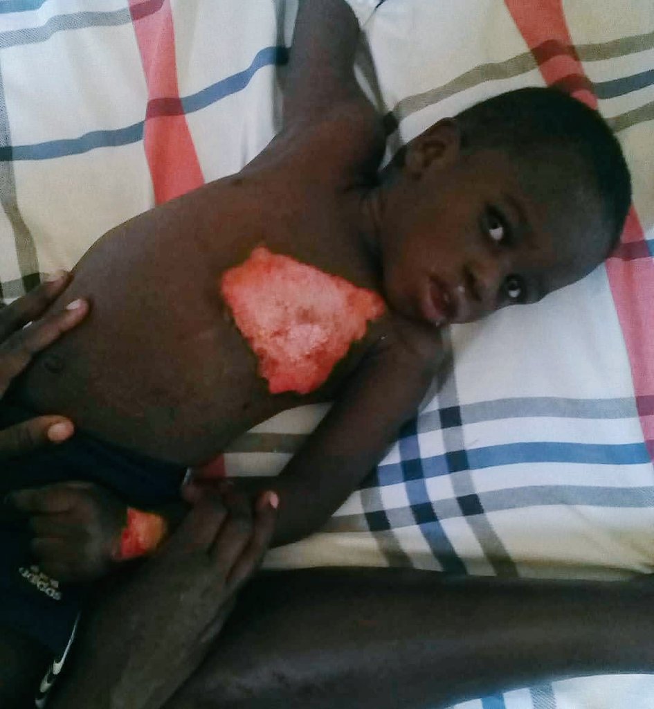 HopeHavenMnstry's tweet photo. A hero is someone who is willing to help others in his or her best capacity. Twitter family please be a hero today by tapping on our link to provide his medical bill, Only $200  is needed. Give now👇👇👇.
https://t.co/wC80iuLfA5 https://t.co/mzTK2L8KEL