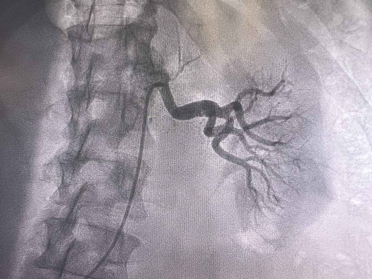 Amir Kaki, MD tweet media