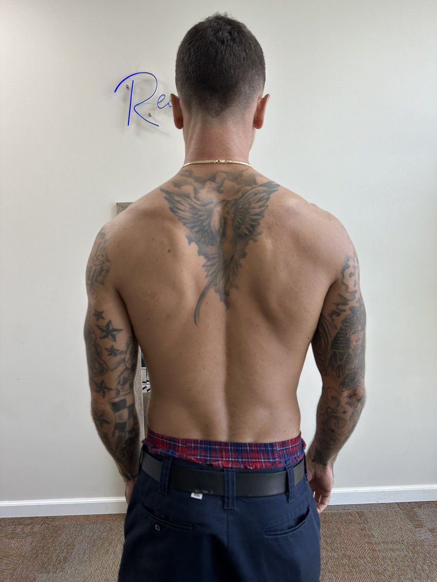 reactivebda's tweet image. Swipe to see before →

Client has been experiencing pain and stiffness in his neck for the last 2 weeks, which has really affected his sleep and movement! Amazing results after just 1 session 🙌🏽

Reduced muscle tension ✅
More symmetrical appearance ✅