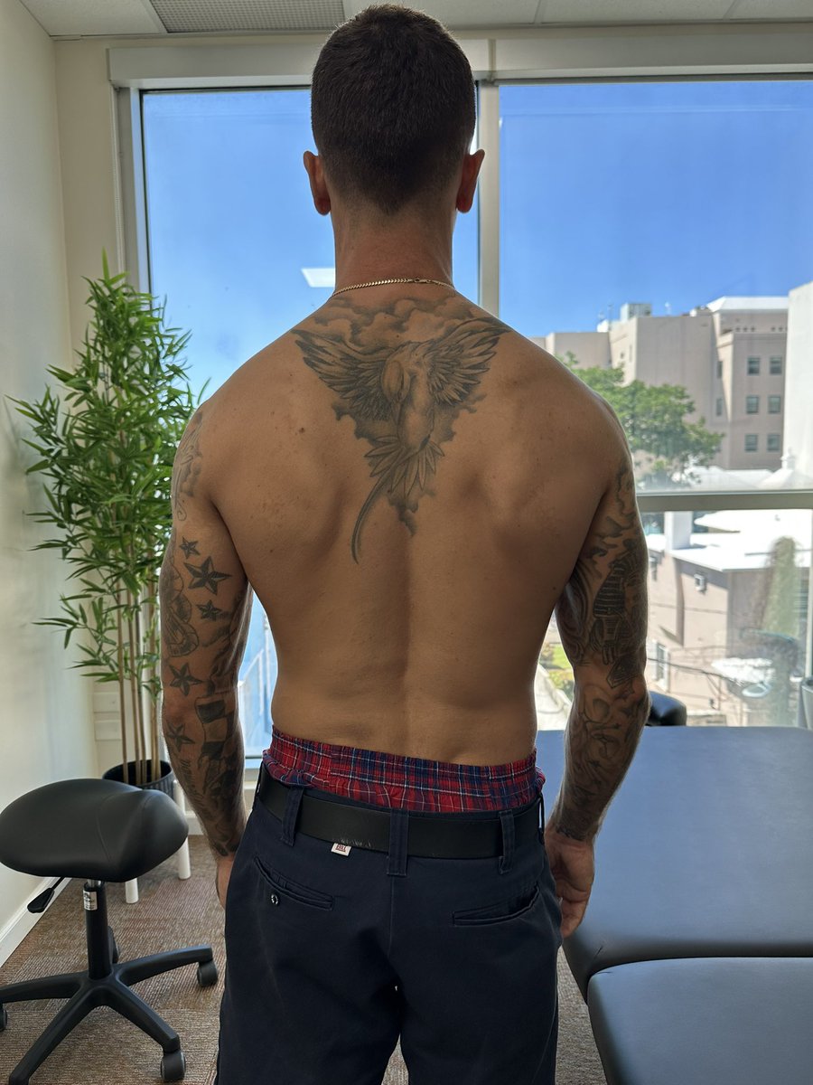 reactivebda's tweet image. Swipe to see before →

Client has been experiencing pain and stiffness in his neck for the last 2 weeks, which has really affected his sleep and movement! Amazing results after just 1 session 🙌🏽

Reduced muscle tension ✅
More symmetrical appearance ✅