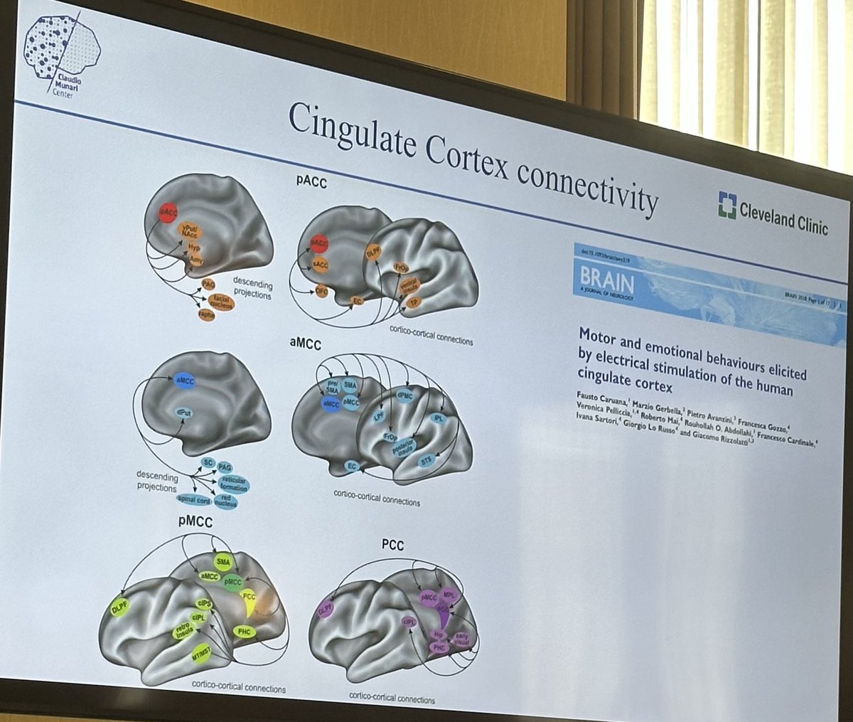 The connections of #cingulate and their implications on #epilepsy #semiology in patients for #epilepsysurgery. ⁦@CleClinicMD⁩ #SEEG course