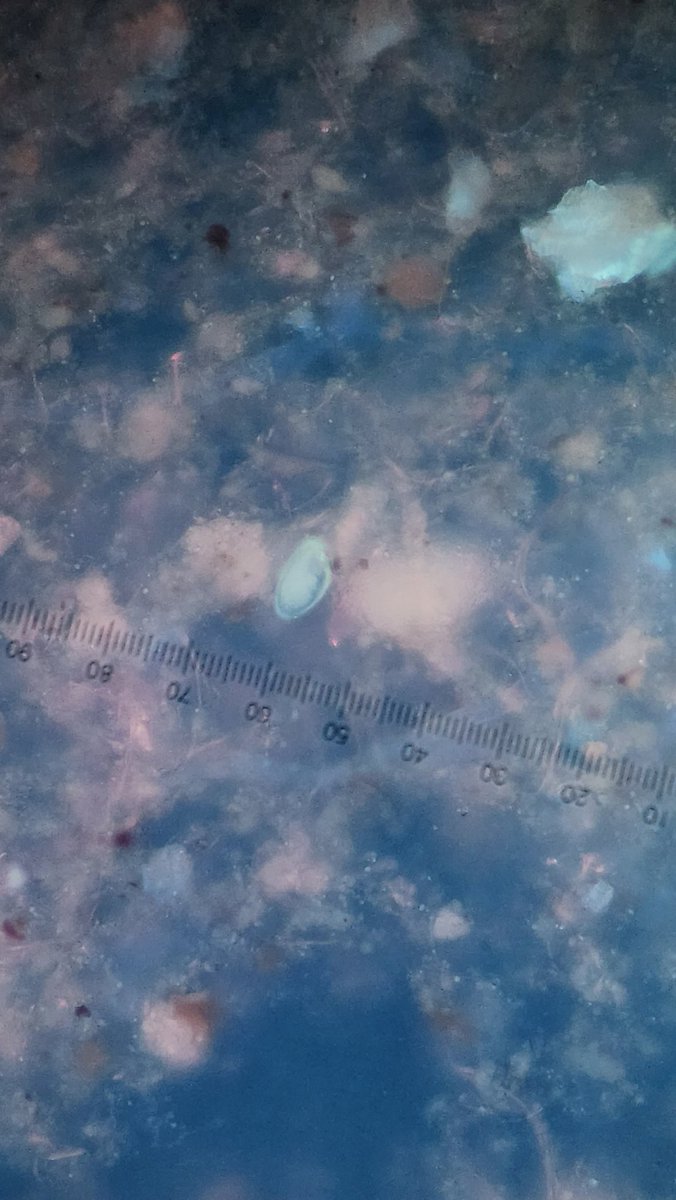 "Dr.C, I found one crummy looking pinworm egg on the wetmount, but I cannot find anymore after 15 mins to confirm!"
UV for the win!
Many helmith ova are autofluorescent under broad range excitation filters! This is a standard filter block used for calcofluor white.
#parasitology