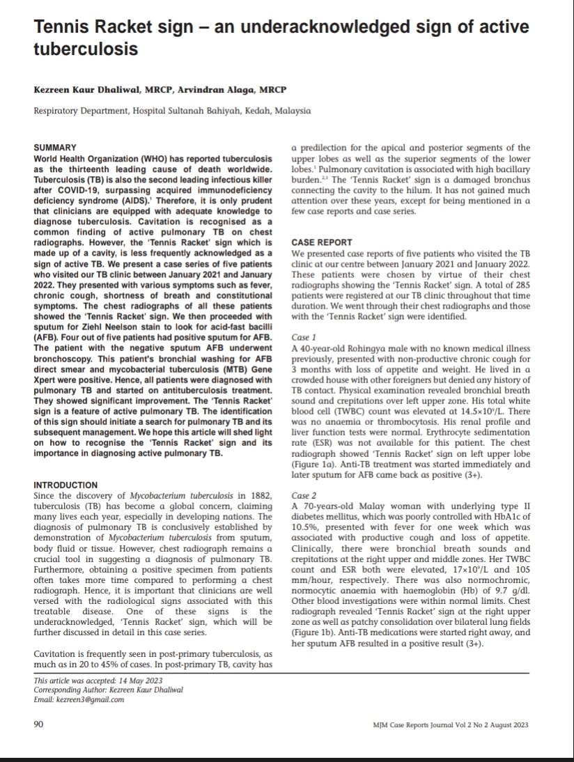 ArvinAlaga's tweet photo. #CHESTAlorSetar
#publication
Another publication from us CHEST Alor Setar . An interesting and educational case series - 'Tennis Racket sign – an underacknowledged sign of active
tuberculosis' published in MJM. https://t.co/cJ1Ur4EuLr