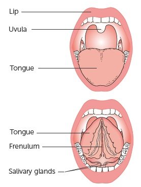 #Tonguecancer most often begins in the thin, flat cells that line the surface of the tongue, called #squamous cells. #Tonguecancer that starts in these cells is called #squamous cell #carcinoma