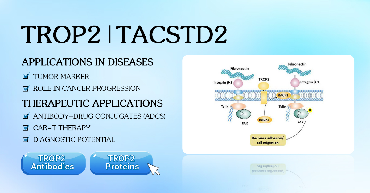 #TROP2/#TACSTD2 is overexpressed in cancers like breast & colorectal. Its potential? Boosting cell growth and enhancing tumor spread. 🧬This makes it a key focus for #CancerTherapies.💡TROP2 research tools by #CUSABIO🔗bit.ly/3QPpFwg #CancerResearch #MedicalBreakthroughs