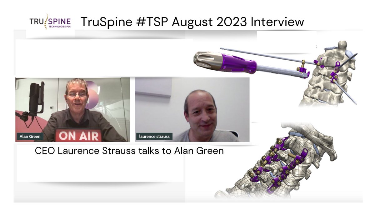 NovusComms's tweet image. #TSP @truspine_plc - CEO Laurence Strauss talks to @Alan__Green 

~ 510k submission to US FDA for Cervi-LOK approval
~ US trip to meet IP lawyers &amp;amp; distributors
~ Cash position &amp;amp; funding plans
~ Near term milestones 

#spinehealth #spinaldevices 

Watch: youtu.be/zxKK9gcQQFY