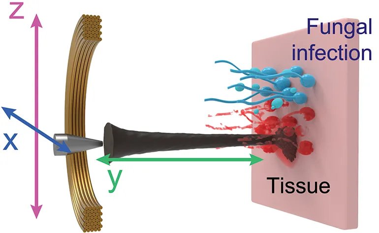 Cn1699's tweet image. Nanorobots Release Reactive Oxygen Species to Kill Fungal Biofilms

#nanorobots #fungalbiofilms #biofilms 

More info | ⬇️
buff.ly/3Nm1PVT