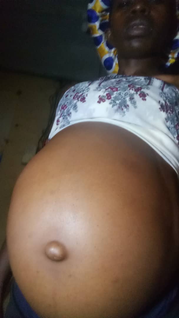 She is not pregnant.  This is fibroid