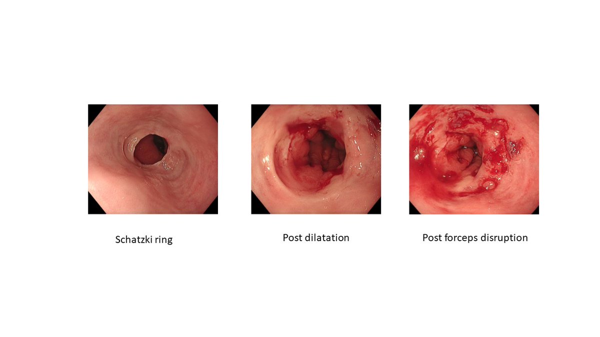 Brisbane Endoscopy tweet media