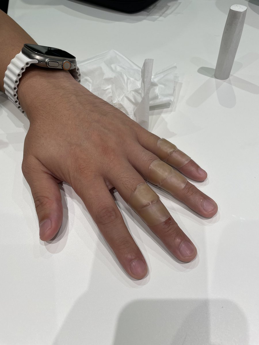 チョコプラの「ラ」更新🆙 〜長田、家の近所で怪我〜