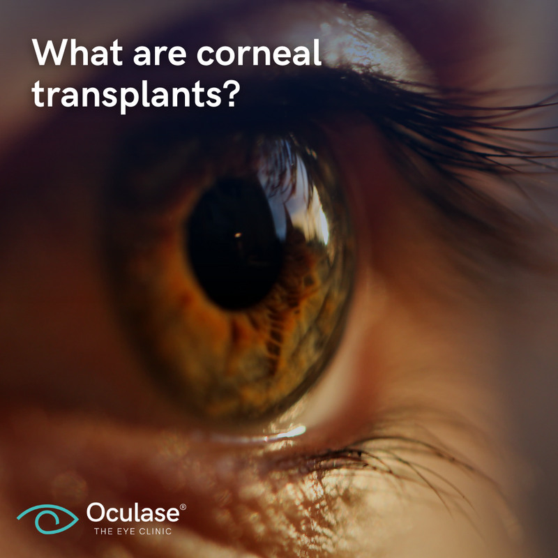 oculase's tweet image. In DALK, the front 90% of the cornea (front and middle layer) is replaced with the front 90% of a healthy donor cornea.

Speak to our eye specialists about DALK today:
🌐 www. oculase.com 
📞 0330128161

#Oculase #EyeHealth #EyeCondition #EyeSpecialist #EyeSurgery