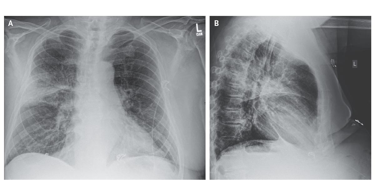 This week’s most viewed articles: 

1. Community-Acquired Pneumonia nej.md/449FCk7

#ClinicalMedicine