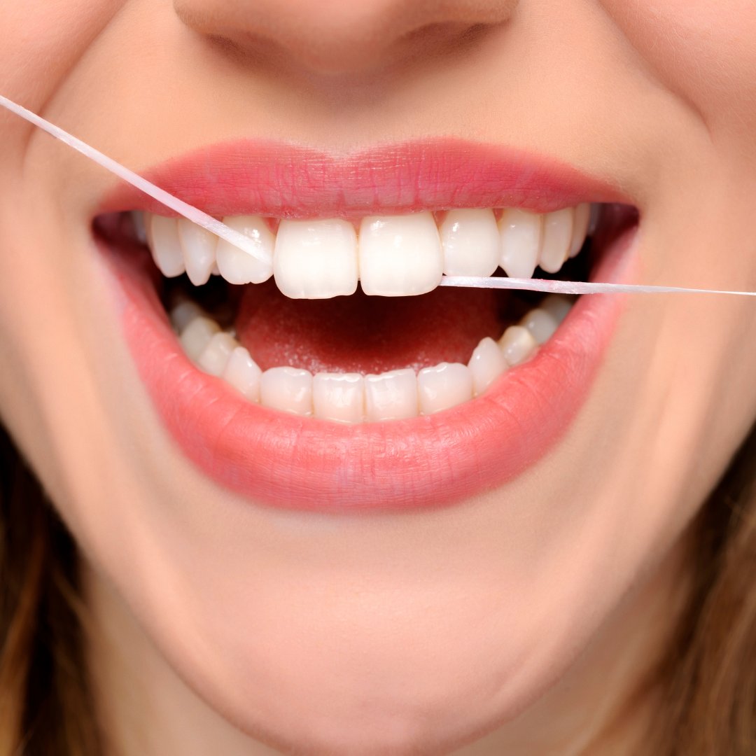 Life Hack: if you floss every day you don’t have to lie to the dentist when they ask if you floss everyday.

#dentist #dentalcare #dentistry #dentalhealth #flossing  #omaha #dentalhygiene
