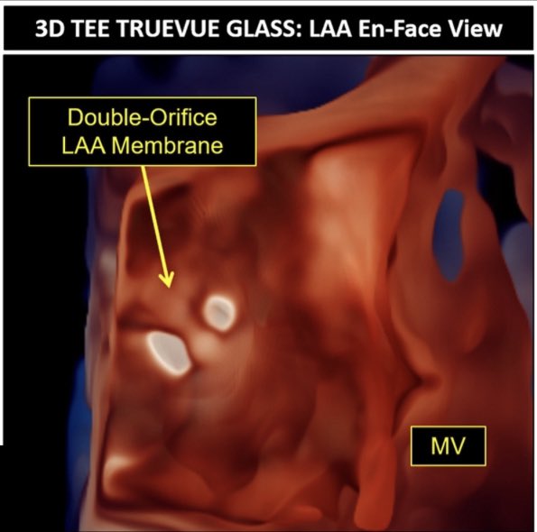 Ritu Thamman MD tweet media