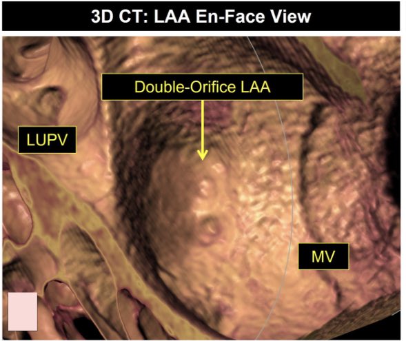 Ritu Thamman MD tweet media