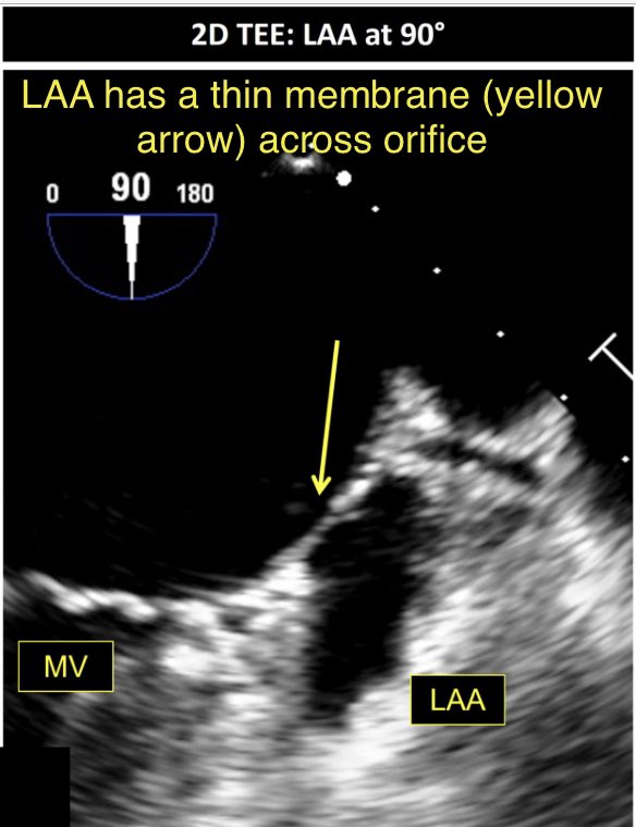 Ritu Thamman MD tweet media