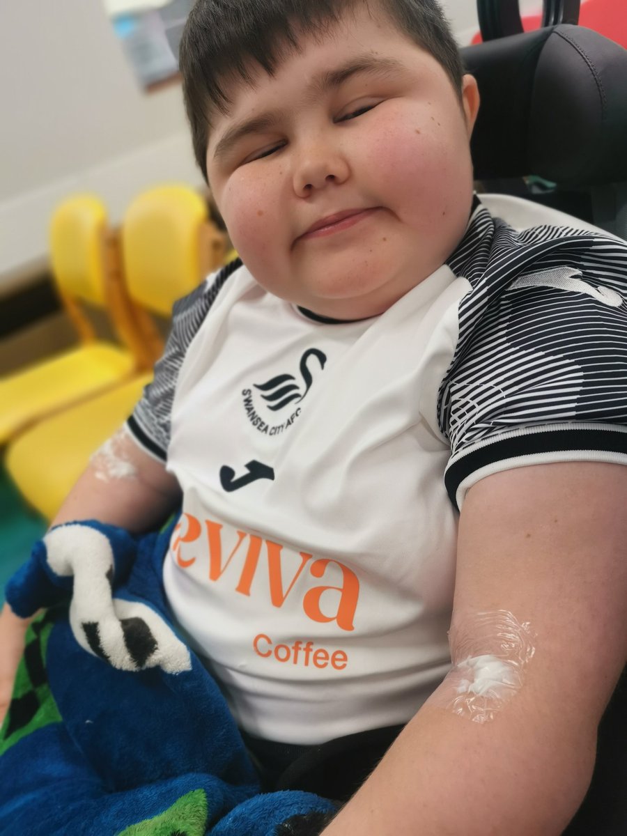 harveysjourney's tweet photo. Prepped with magic cream ready for the full works today 🙈. Fingers crossed for no heart changes 🤞#singletonhospital #harveysjourney #duchennelife https://t.co/um6v1j8g2p