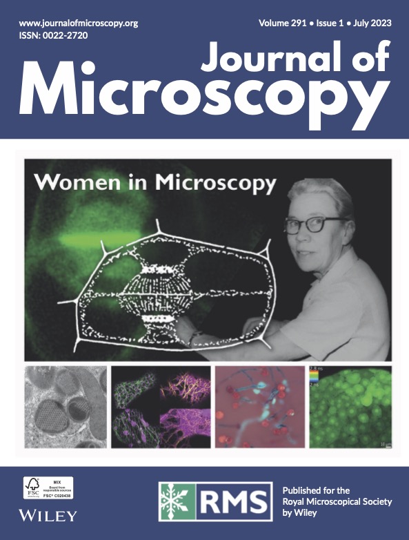 We have recently published an Invited Review, due to appear in the upcoming themed issue 'Women in Microscopy: Part2':

"Made to measure: An introduction to quantifying microscopy data in the life sciences". 

The paper is free-to-view &gt; onlinelibrary.wiley.com/doi/10.1111/jm…

<a href="/RoyalMicroSoc/">RMS</a>