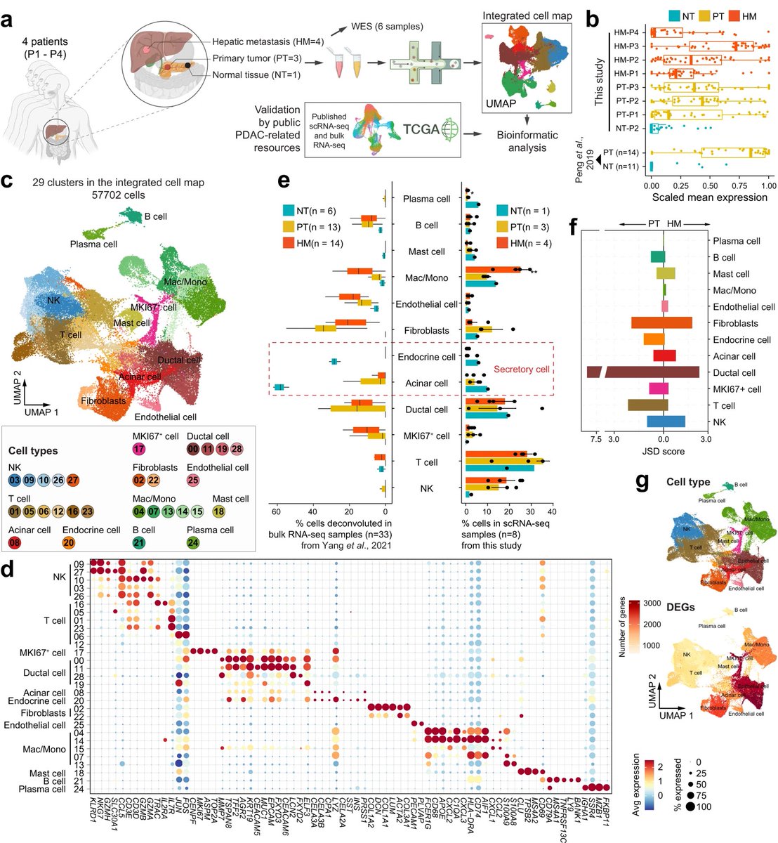 Small dataset from four patients but still useful to #PancreaticCancer researchers - single cell RNA-seq of MATCHED primary tumor &amp; liver metastases. Most published series including our own have been with unmatched primary &amp; metastatic cases. In <a href="/NatureComms/">Nature Communications</a>