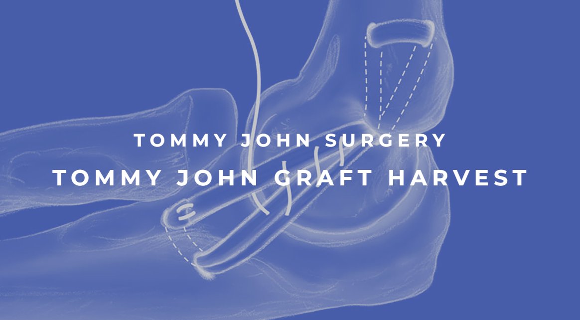 drchrisahmad's tweet photo. #ThrowingThursday - Tommy John Graft Harvest Explained: https://t.co/cd6c6Sy6nn☑️
#understandingtommyjohn #tommyjohnsurgery #baseballsportsmedicine #shoheiohtani #baseball #tommyjohn #tjsurgery #elbowpain #elbowsurgery
⭐️⭐️⭐️⭐️⭐️ https://t.co/MDm3cHdzGK