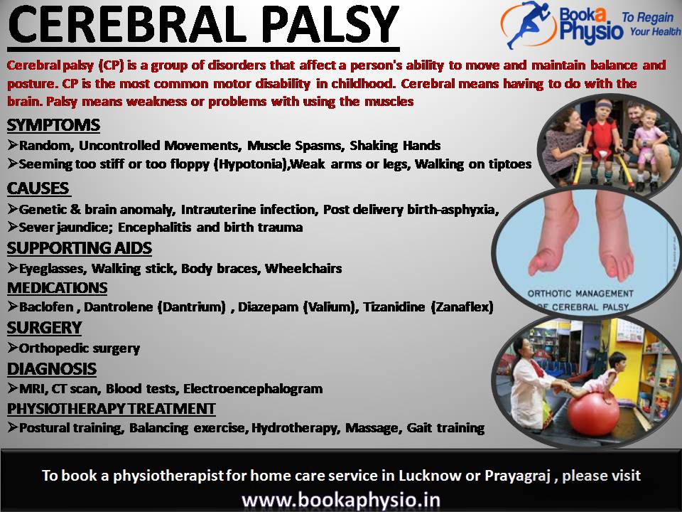 BookPhysio's tweet photo. Cerebral Palsy physiotherapy treatment.......
https://t.co/juCfLsWxR3 #BookaPhysio #Lucknow 
#BestPhysiotherapistinLucknow #Prayagraj #bestphysiotherapistinprayagraj #physiotherapistforhomevisit #cerebralpalsy #cerebralpalsyawareness #cerebralpalsykids #cerebralpalsywarrior https://t.co/5SfpBOsajC