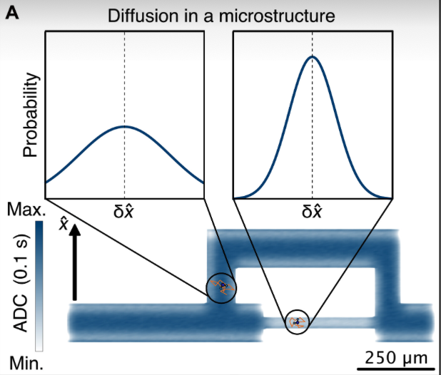 Hey #NMRchat, we are very excited to share one of our most important results so far: Imaging anistropic water diffusion in the microstructures using diamond quantum sensors. Read it in @ScienceAdvances: science.org/doi/full/10.11…
#NMR #MagneticResonance NMRspectroscopy