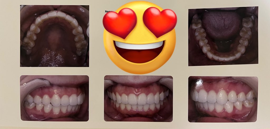 🌰💉 tweet media