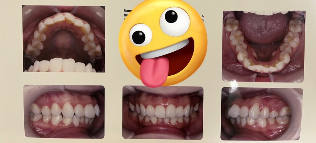 🌰💉 tweet media