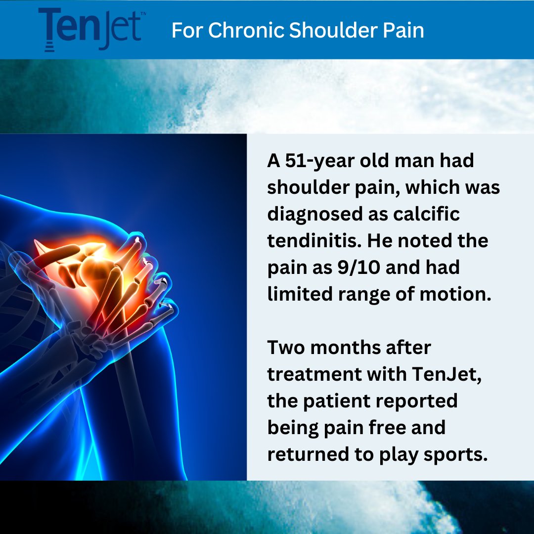 Dr. Michael Dakkak of the Cleveland Clinic uses TenJet to treat patients with chronic tendon pain. In this case, a man with shoulder pain was able to return to sports pain free after treatment with #TenJet.
Learn more: hydrocision.com/product/tenjet…

#tendinosis #shoulderpain