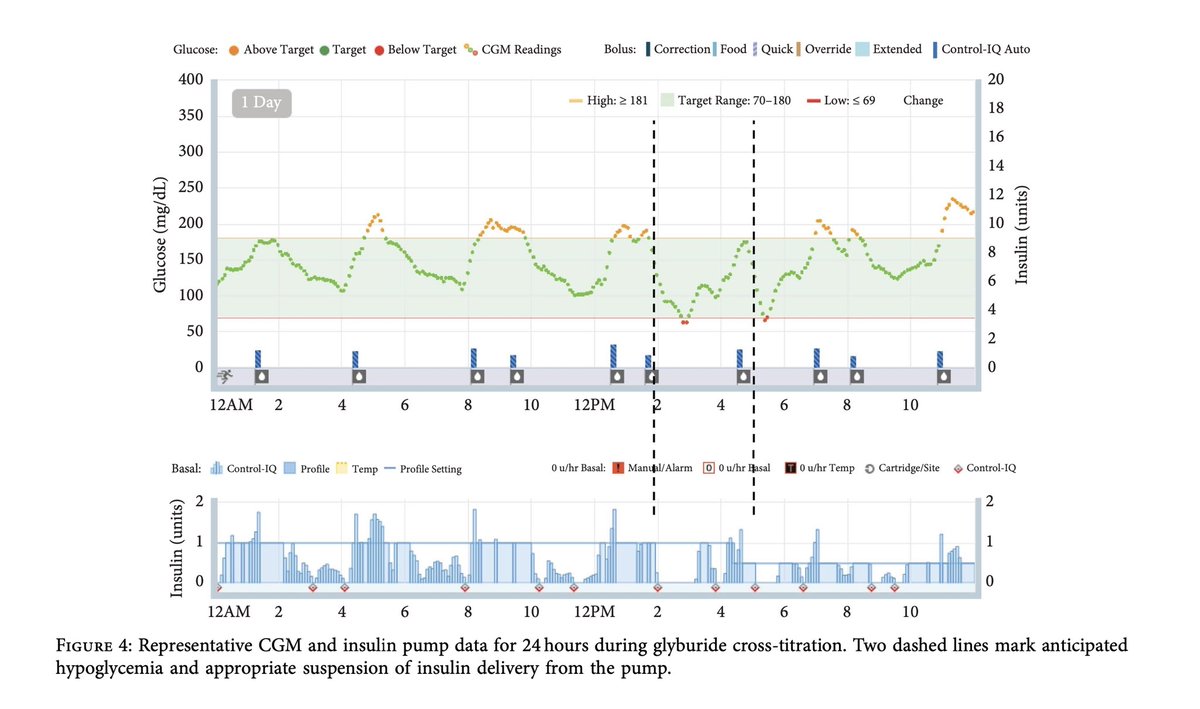 StanfordPedsEndo (@stanfordpedendo) on Twitter photo New from <a href="/PriyaPrahalad/">Priya Prahalad</a> and Mindy Lee - combining a precision genetic diagnosis with new diabetes technology & remote monitoring - #precisionmedicine hindawi.com/journals/crie/… New from <a href="/PriyaPrahalad/">Priya Prahalad</a> and Mindy Lee - combining a precision genetic diagnosis with new diabetes technology & remote monitoring - #precisionmedicine hindawi.com/journals/crie/…