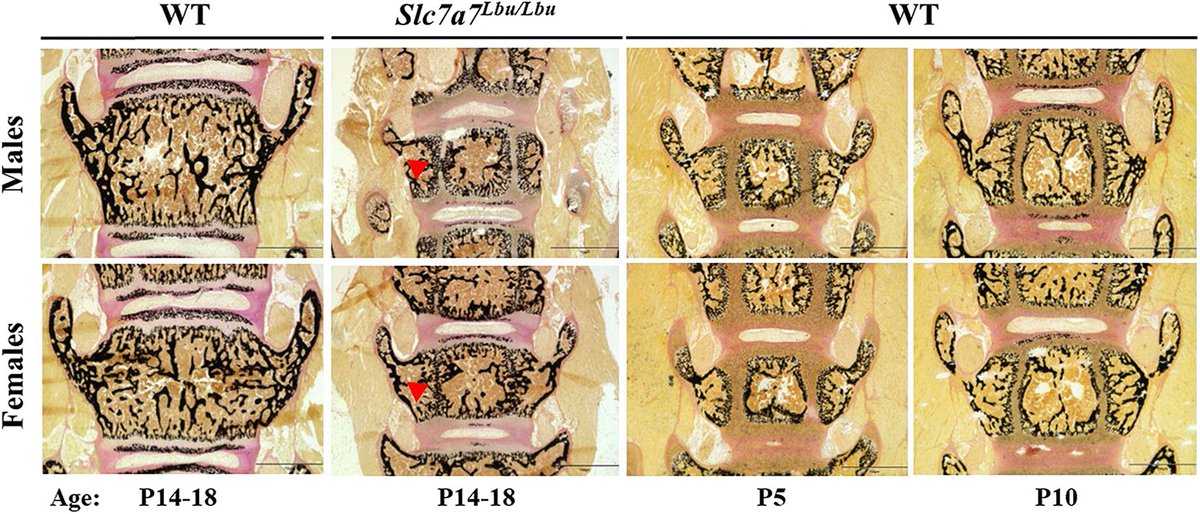 DMM_Journal's tweet photo. Lindsay Burrage &amp; team @bcmhouston show that global Slc7a7 deficiency causes postnatal growth failure with low plasma IGF-1 concentrations and delayed #SkeletalDevelopment in a mouse model of #LysinuricProteinIntolerance

📰https://t.co/7NJrpKBSyo https://t.co/JFoQHcc4C4