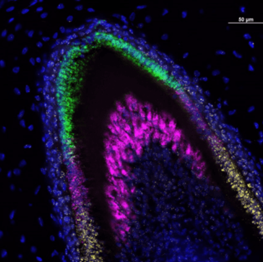 When we think of stem cells, we don't often think of teeth 🦷, but new research out of @UWISCRM is having us think again. 'The ability to generate tooth #organoids may usher in a 'Century of Living Fillings''. Read more about @hannele89072027's findings: bit.ly/3E5pohp